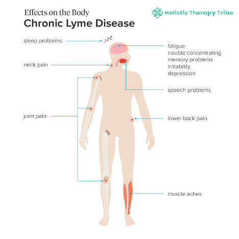 chronic-lyme-disease.png