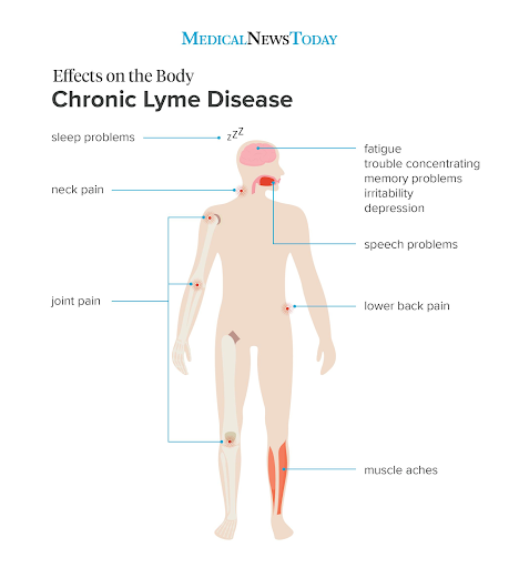 Chronic Lyme Disease Long-term Effects