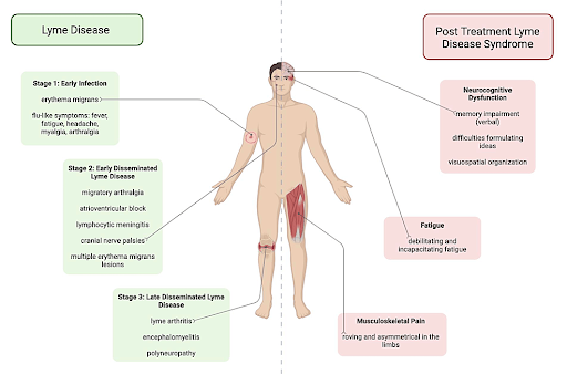 Chronic Lyme Disease Symptoms