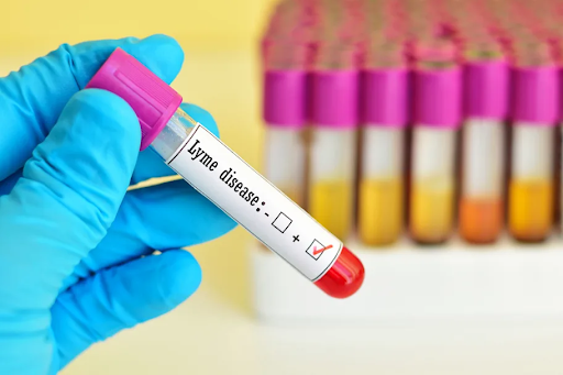 lyme-disease-diagnosis