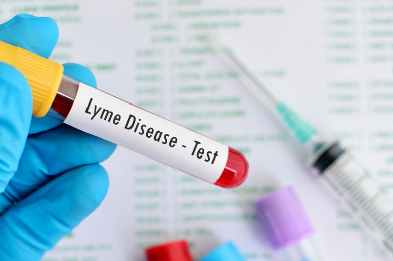Lyme Disease Test
