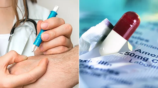 lyme-disease-treatment-options