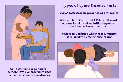 Types of Lyme Disease Tests