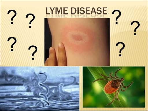 Lyme