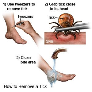 prevent infection