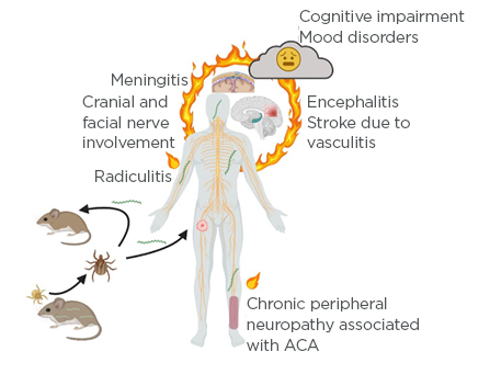 What Is Neuroborreliosis.png